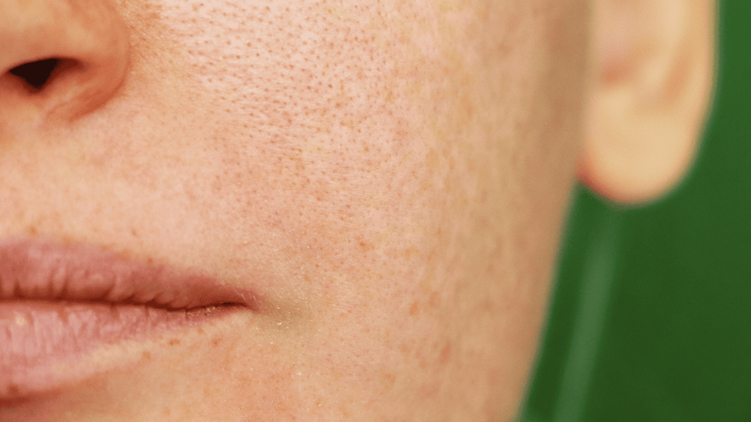 Late summer pigmentation: why it appears now