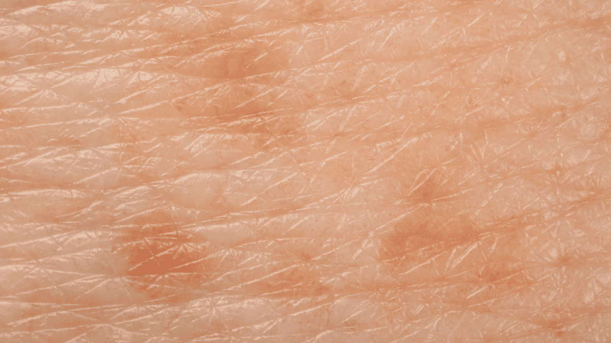 Skin texture: what causes roughness and how to improve it