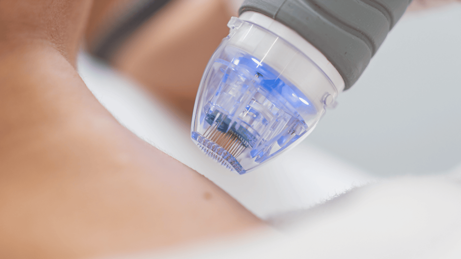 Microneedling Support