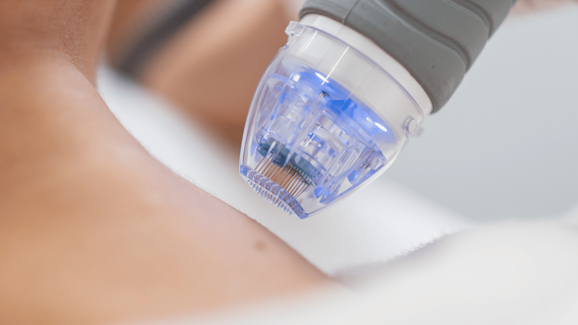 Microneedling Support