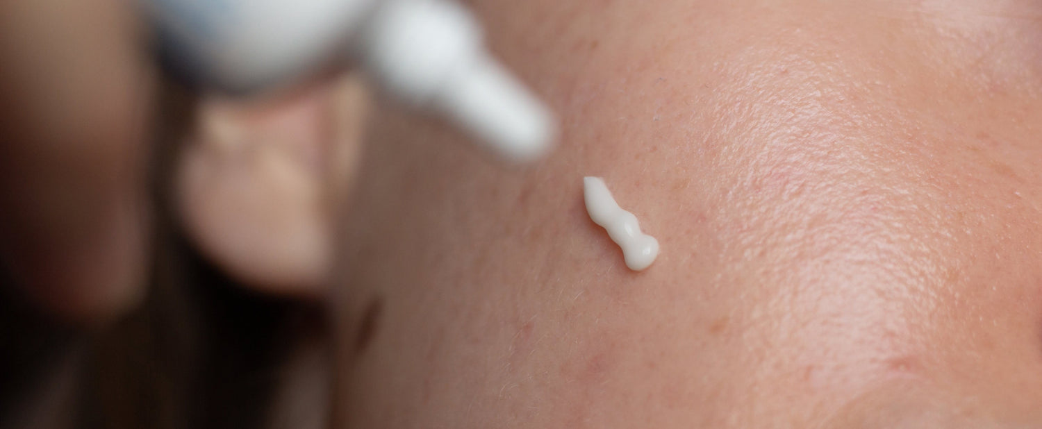 Hyperpigmentation &amp; Dark Spots