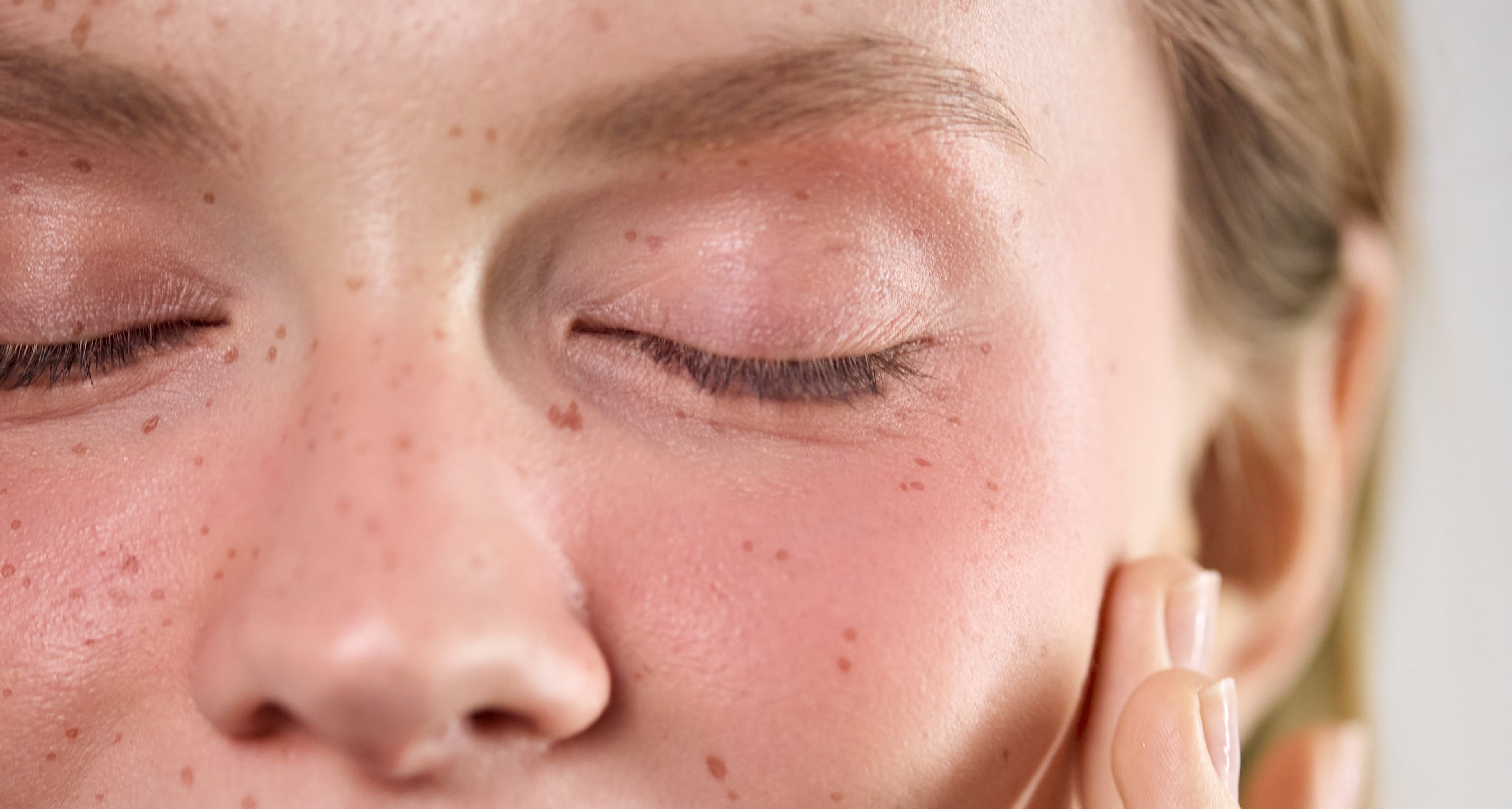 Sensitive Skin