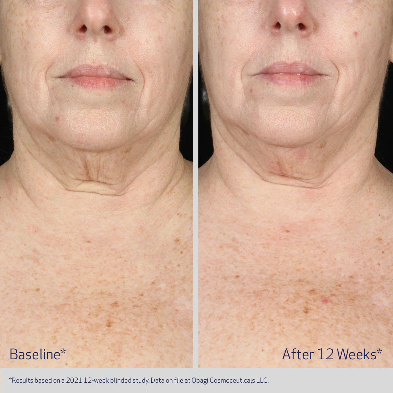 Before and after comparison of a person&