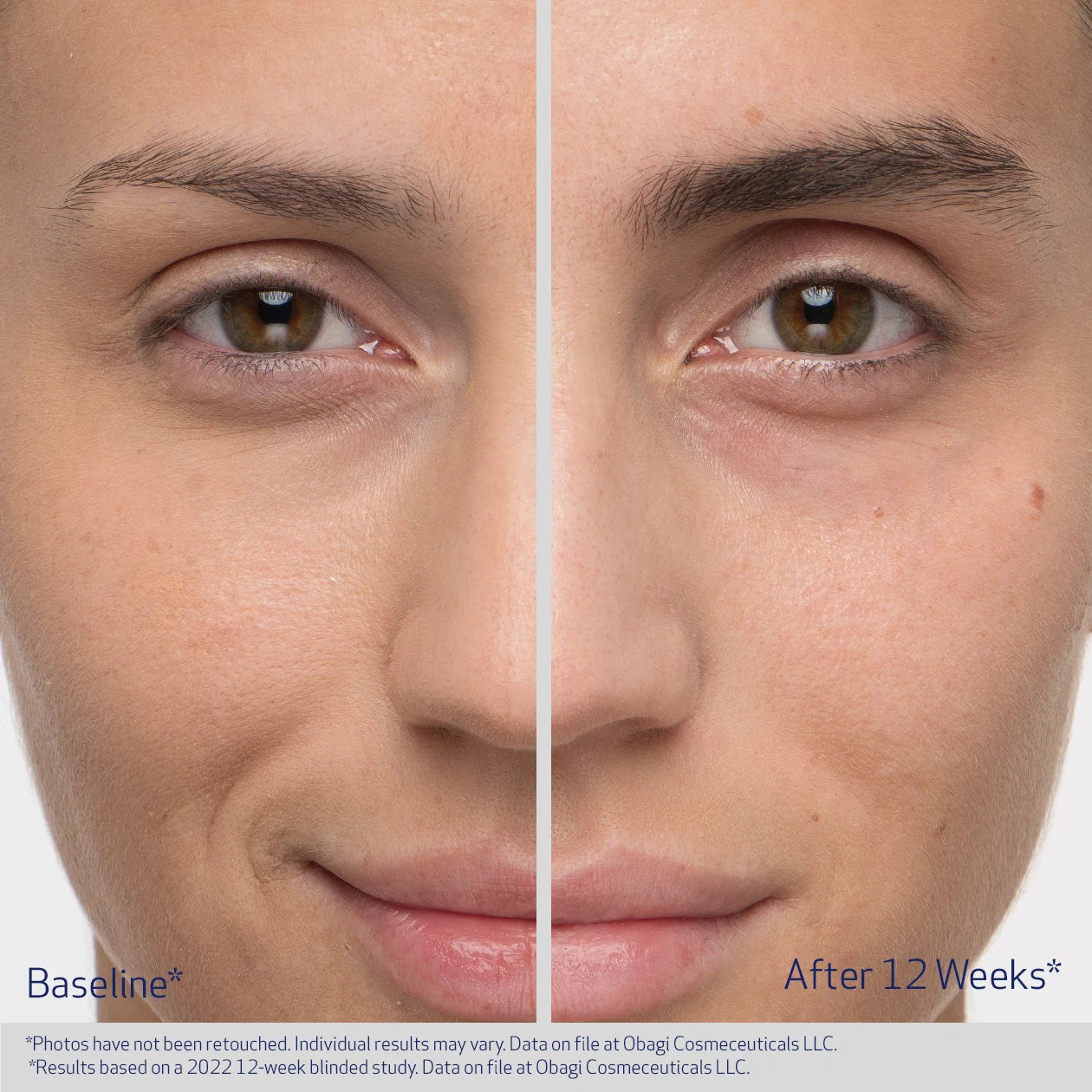 Before and after comparison of a person&