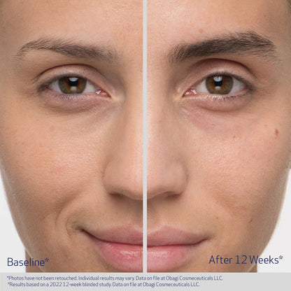Before and after comparison of a person&
