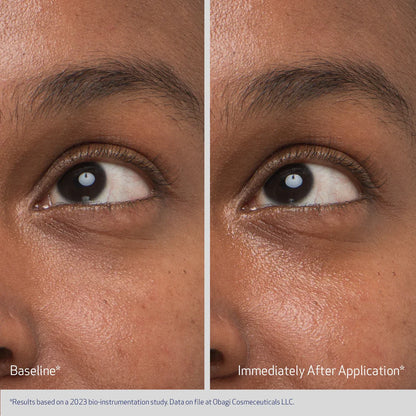 Before and after comparison of eye area treatment on a person&