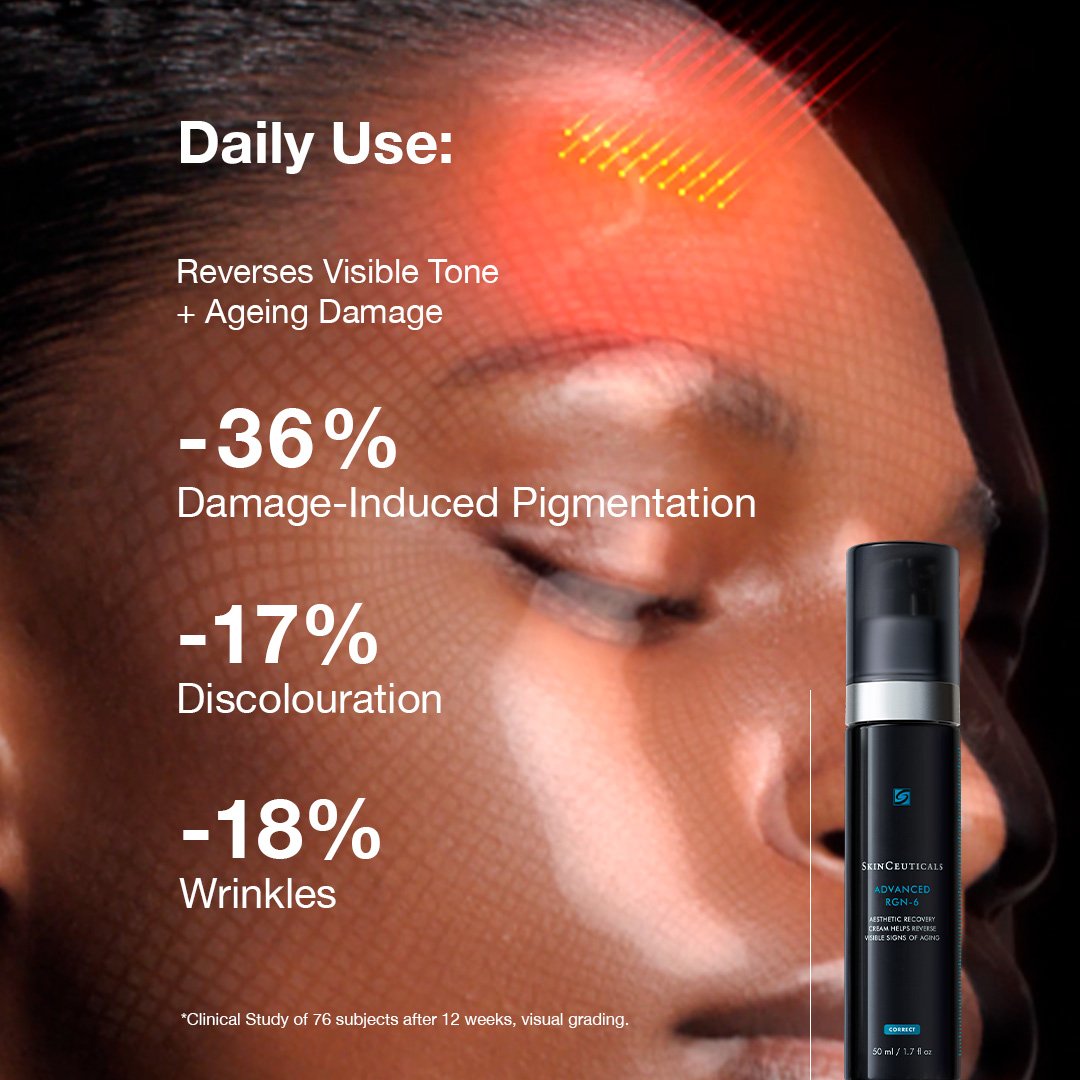 skinceuticals advanced rgn 6 cream with claims of reversing visible tone and aging damage on a close-up of a person&