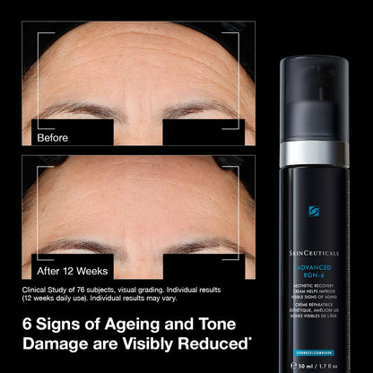 Before and after comparison of skin aging and tone damage with skinceuticals advanced rgn 6 cream